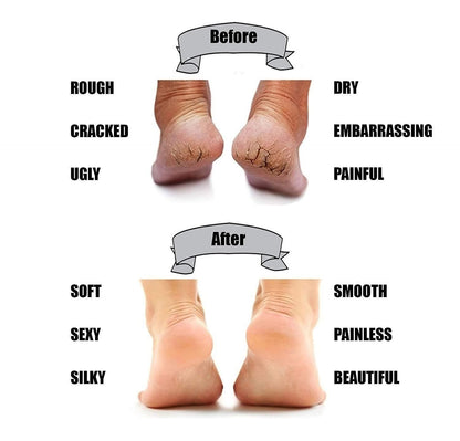 Silicon Gel Pad Heel Protector Socks