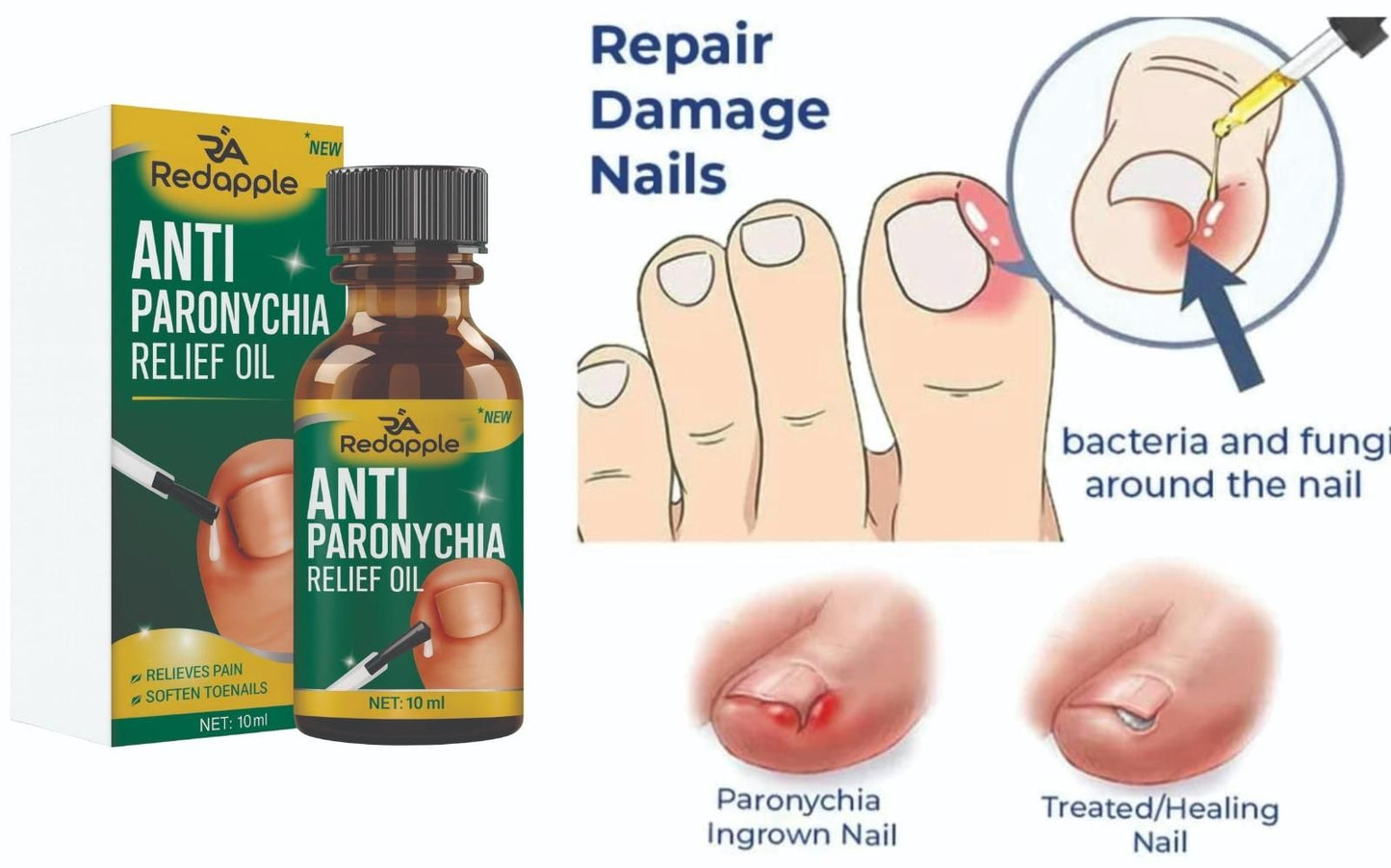 Anti Paronychia Relief Oil 10 ml Pack of 1